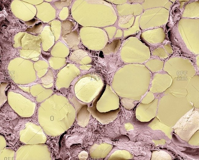 Thyroid gland colored scanning electron micrograph (SEM) of a fracture through the thyroid gland revealing several follicles (yellow)