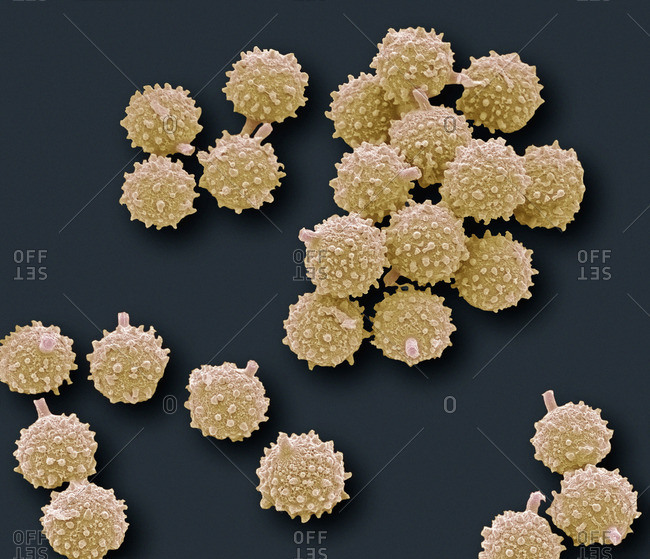 Puffball fungus spores, colored scanning electron micrograph (SEM) These are the reproductive cells of the fungus