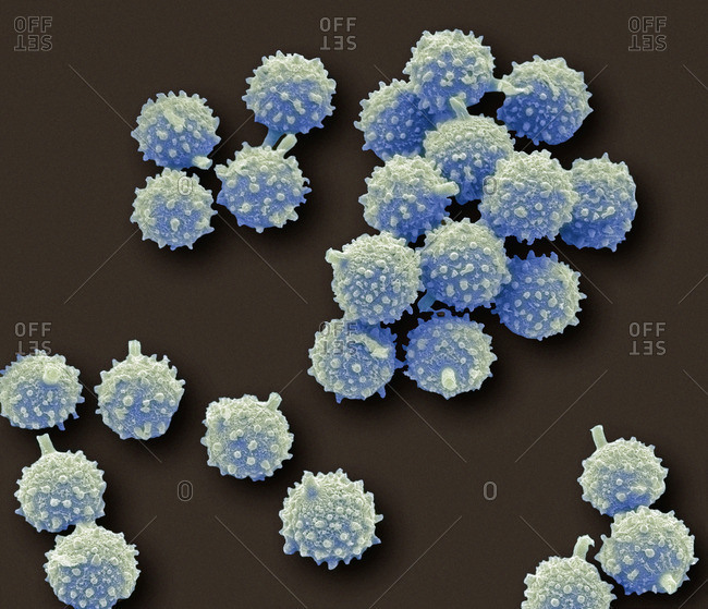 Puffball fungus spores, colored scanning electron micrograph (SEM) These are the reproductive cells of the fungus