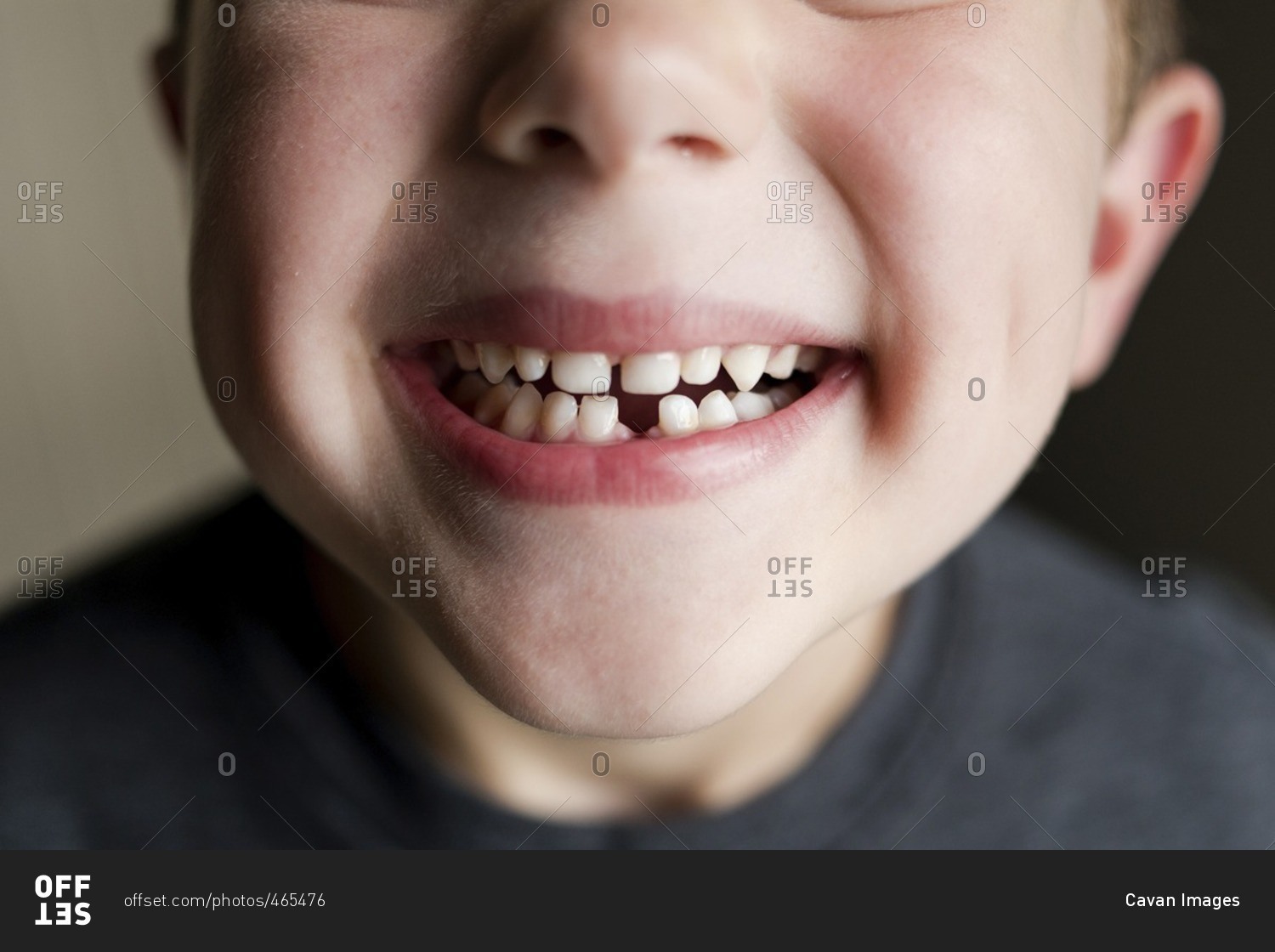 Close-up of boy showing gap toothed