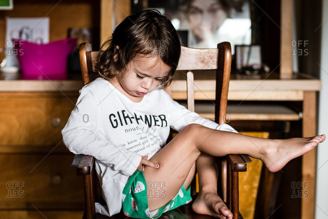 Little Girl Sitting In A Chair Pointing To An Injury On Her Leg