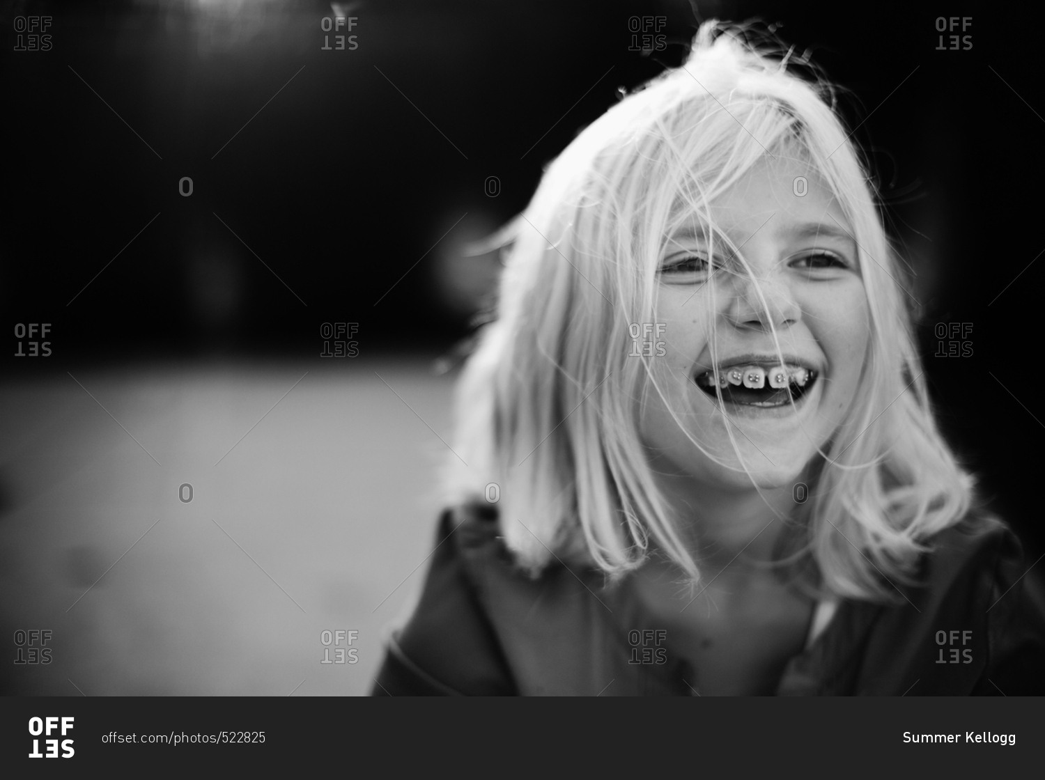 Cute laughing young girl with braces on her teeth stock photo - OFFSET