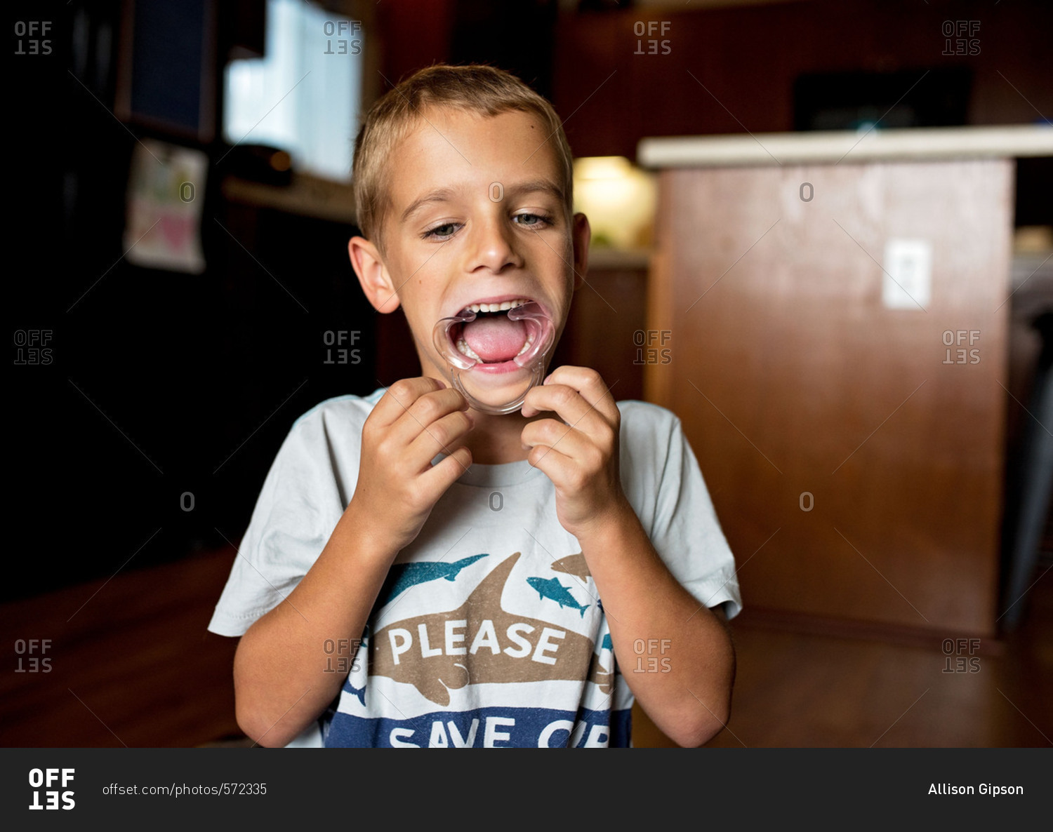 Boy using a cheek retractor stock photo - OFFSET