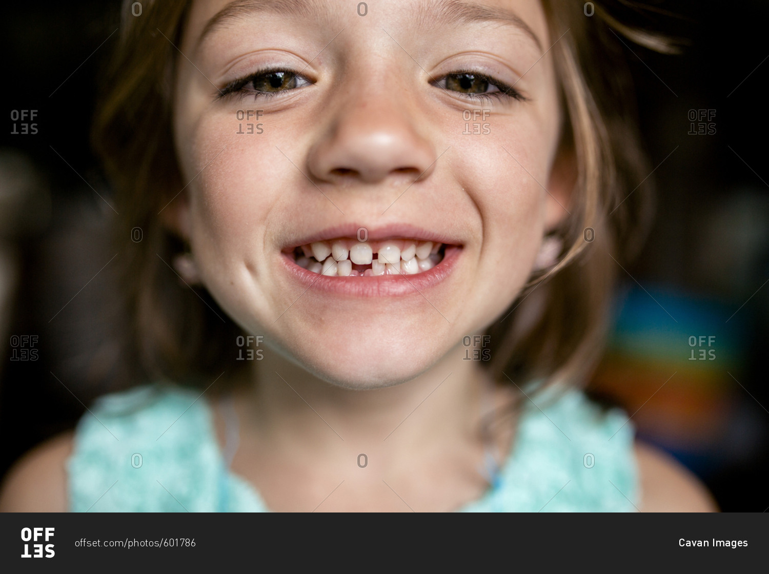 Close Up Portrait Of Girl Showing Gap Tooth Stock Photo OFFSET