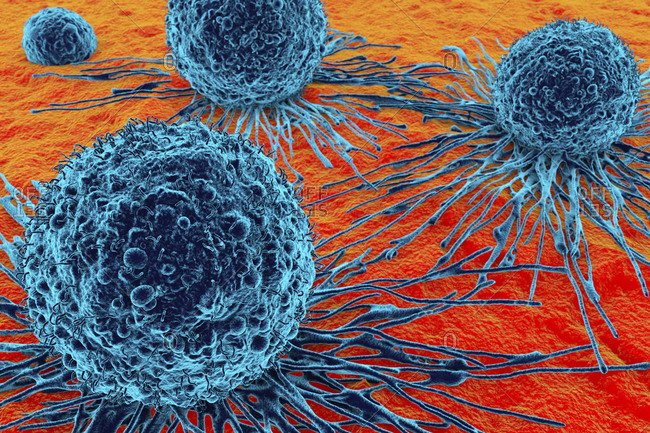 Cancer cells, illustration