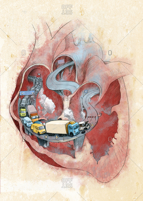 Clogged heart, conceptual illustration - Offset