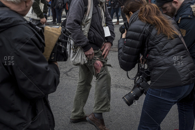 Washington, DC - JANUARY 20, 2017: A Photographer is photographed by other photographers while showing where his clothing was ripped and his leg injured during Donald Trump Inauguration Day Protests