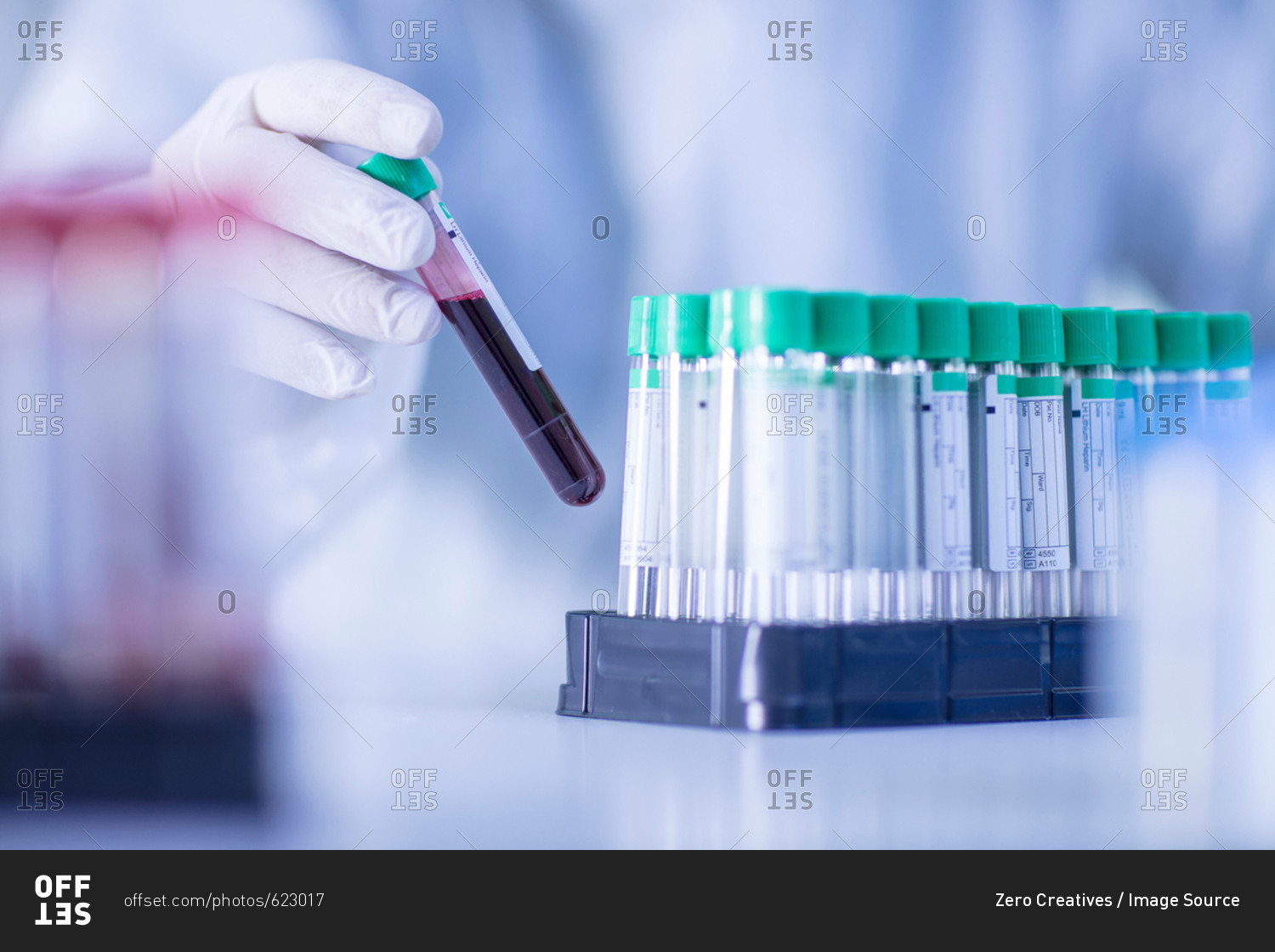 Laboratory worker placing liquid filled test tube in rack. close-up