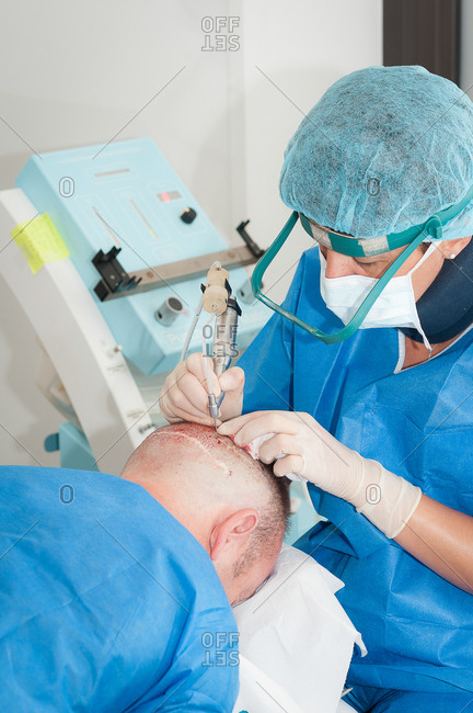 September 22, 2016: Reportage in the Mozart plastic surgery clinic in Nice, France. FUE (Follicular Unit Extraction) hair transplant on a patient who has already undergone two strip harvesting sessions which have left scars. FUE will avoid this. FUE involves harvesting individual follicular units using a hollow needle that is 0.9-1.2mm in diameter, and reimplanting them in the bald patch