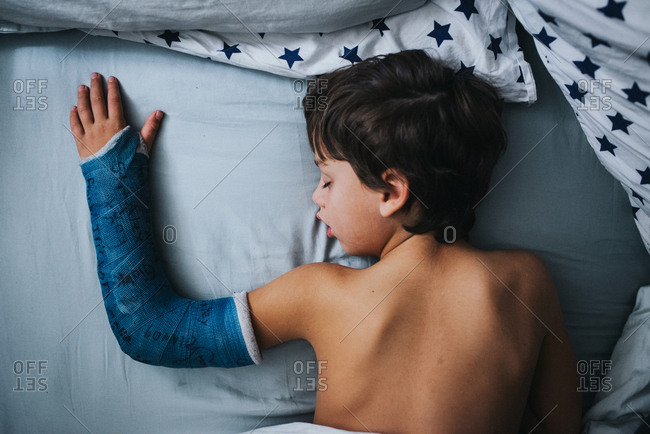 Little boy sleeping in bed with blue arm cast