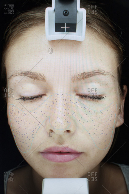 Image of young woman's face in skin clinic