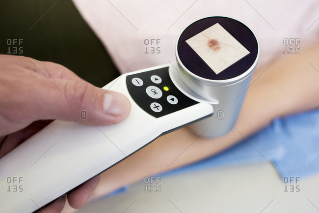 Examining mole on patient's arm
