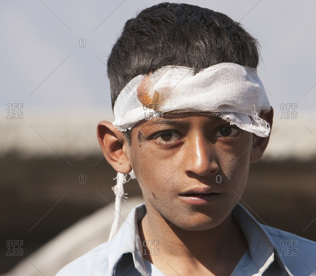 November 6, 2005: Boy Injured By The 8 October 2005 Earthquake, Chikar, Azad Kashmir, Pakistan