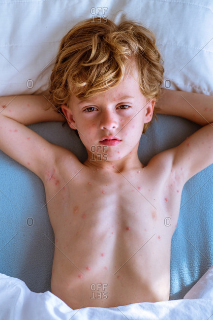 Young little boy lying and sleeping in bed with thermometer and feeling sick.