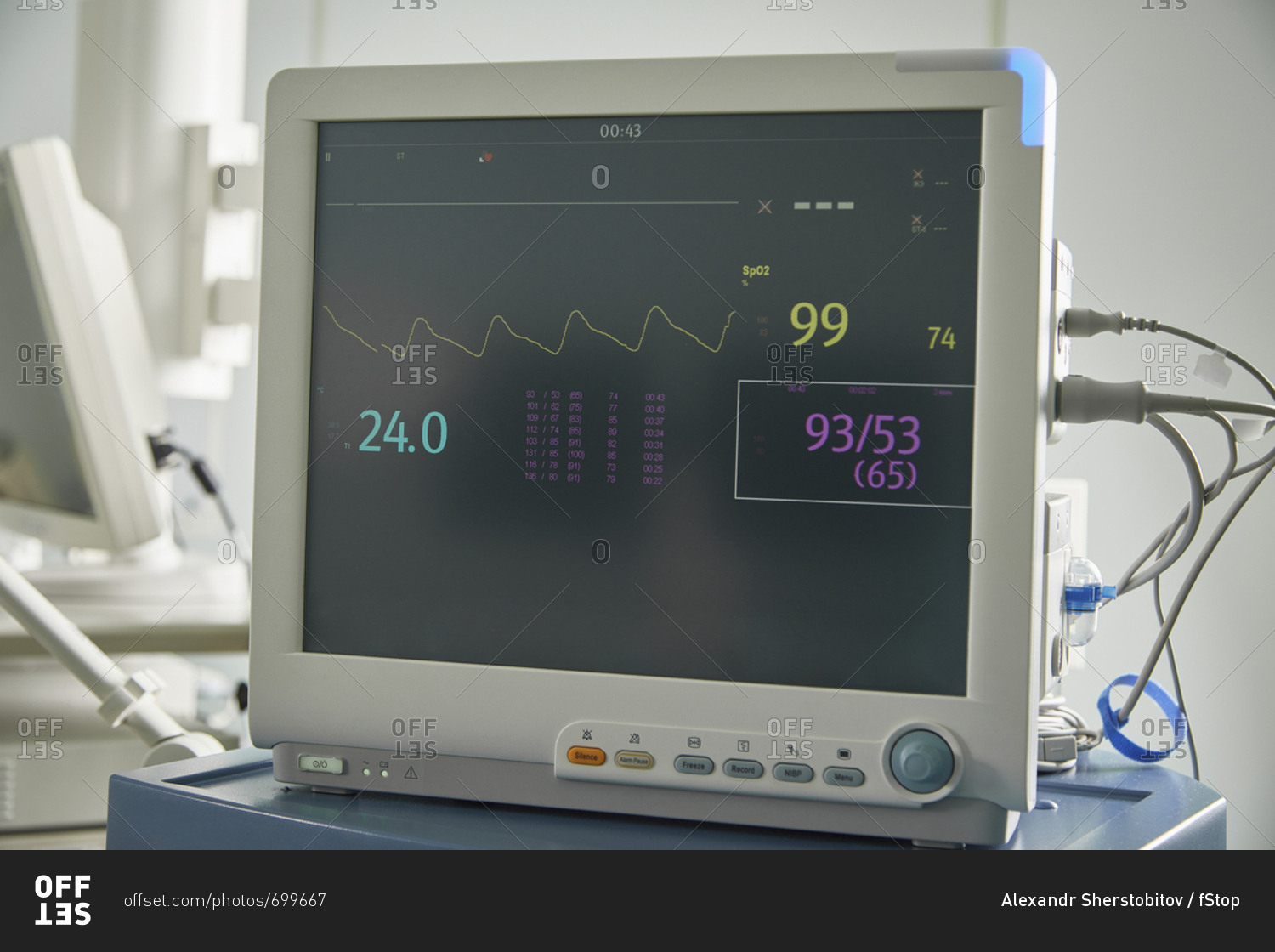 Close-up of monitoring equipment with medical data on screen in hospital ward