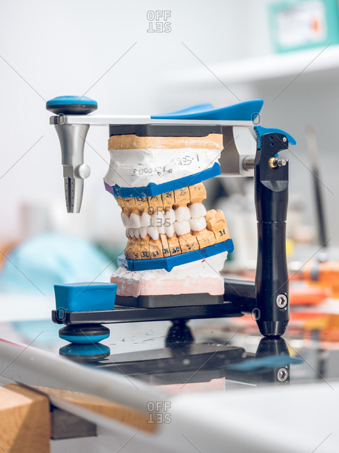 Denture with ceramic teeth standing on holder in modern dental lab.