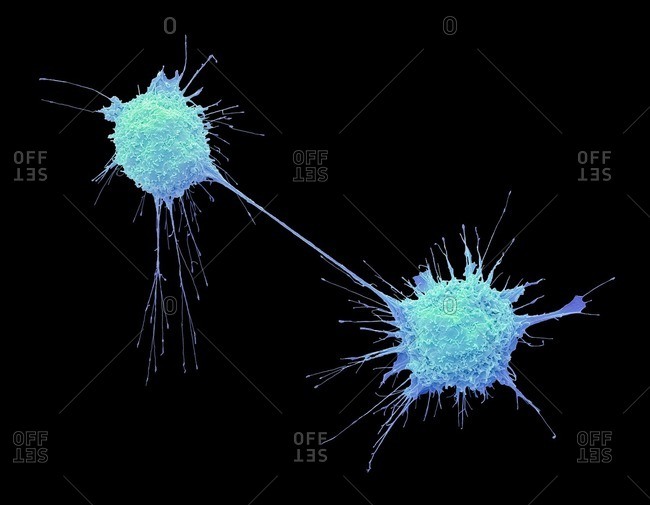Dividing prostate cancer cells, SEM