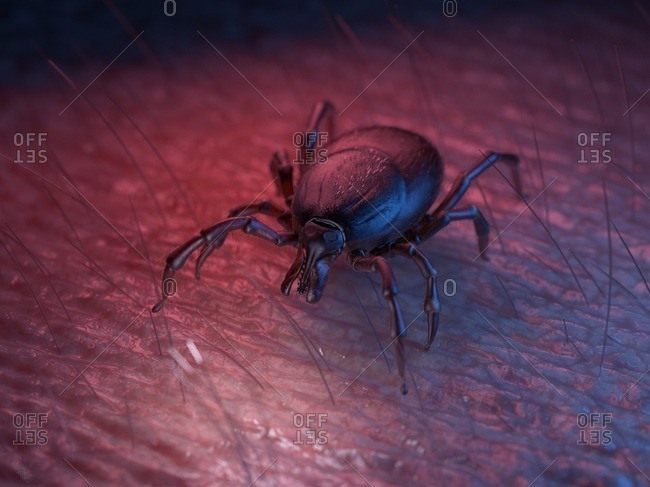 3d rendered illustration of a tick on skin.