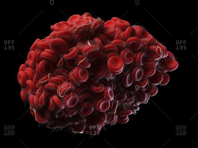 Illustration of a blood clot.