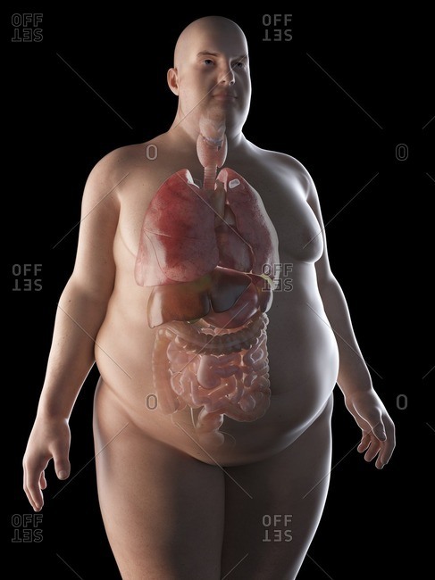 Illustration of an obese man\'s organs.