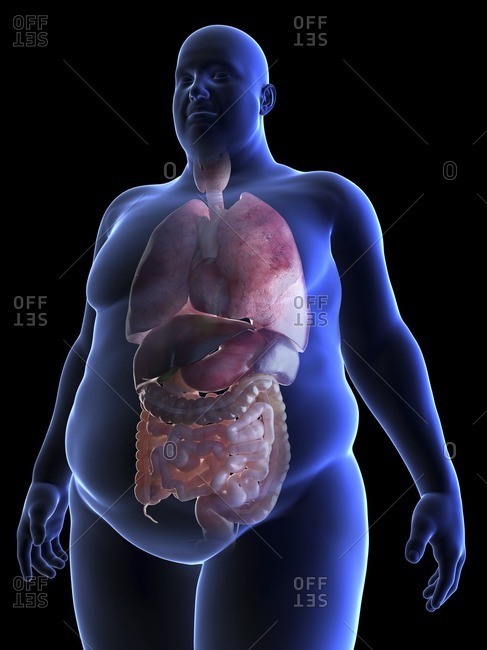Illustration of an obese man\'s organs.