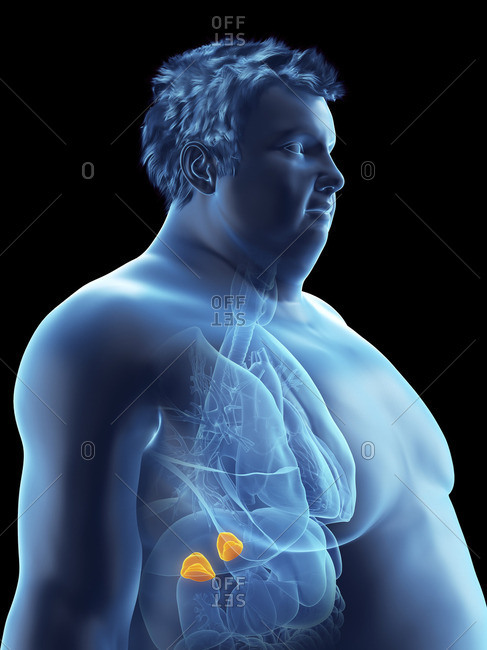 Illustration of an obese man's adrenal glands.