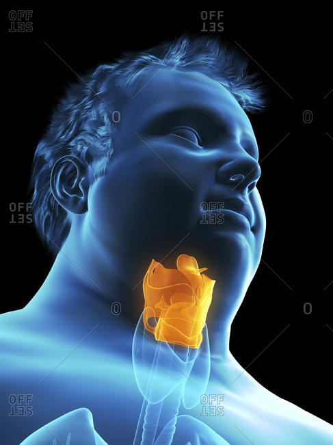 Illustration of an obese man's larynx.