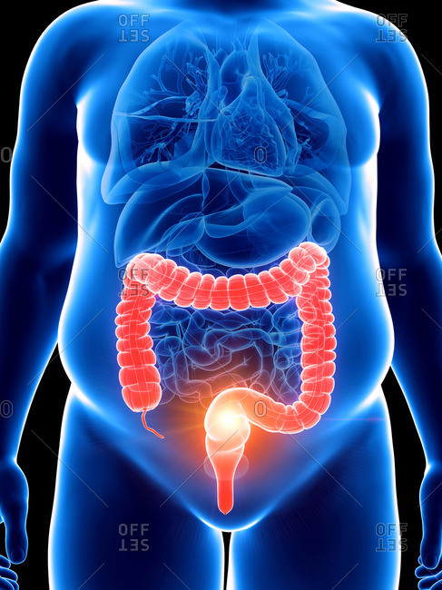Illustration of an obese man with a painful colon.