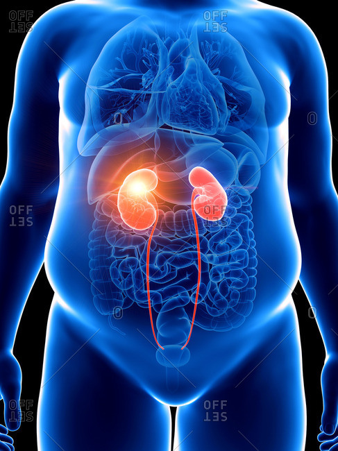 Illustration of an obese man with a painful kidney.