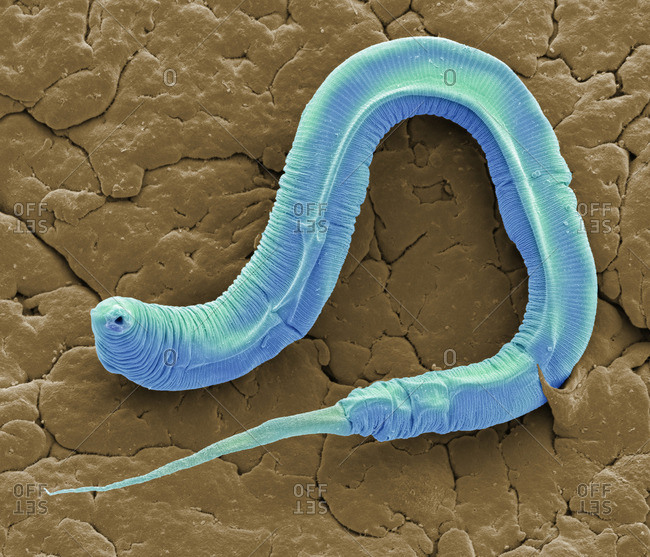 Caenorhabditis elegans worm - Offset Collection