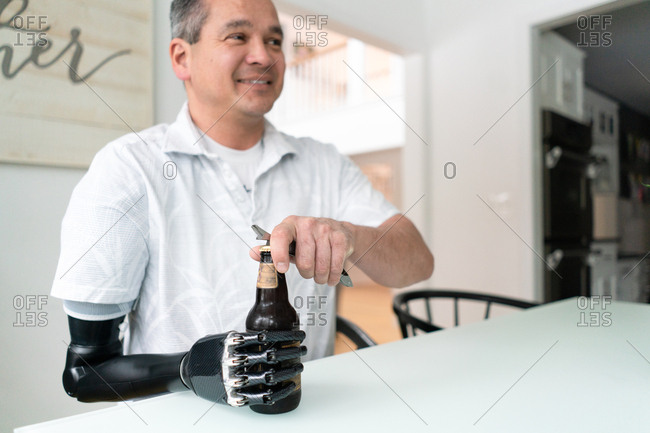 Man with bionic prosthetic arm opens a beer bottle at home