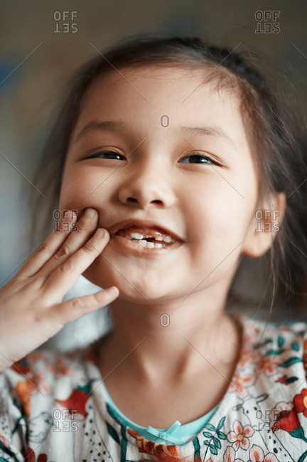 Cute smiling girl with new front teeth