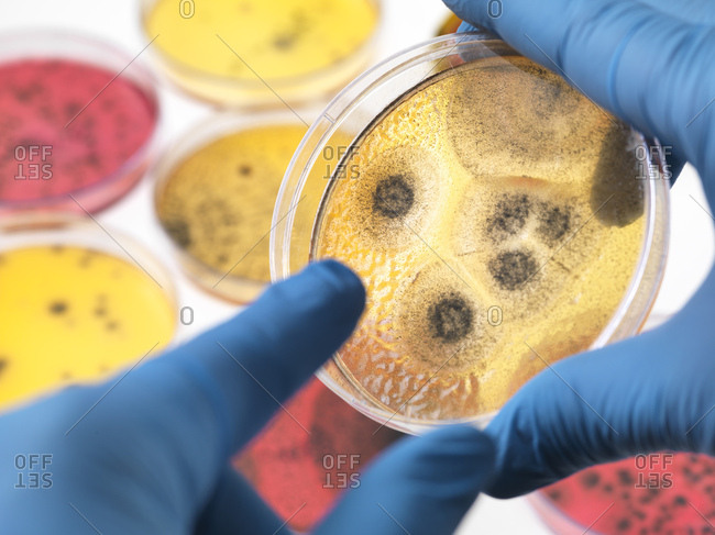 Scientist examining petri dishes containing bacterial growth in the laboratory