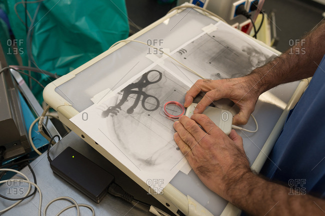 Deep brain stimulation