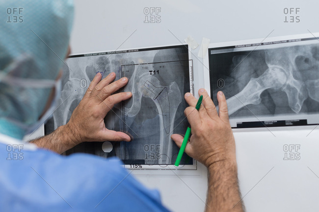 Hip prosthesis surgery