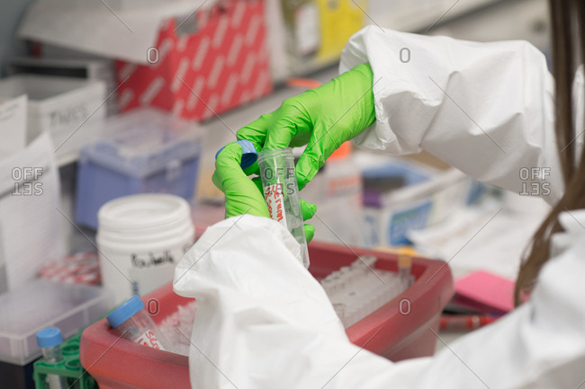 Hepatology service of hospital Nice France