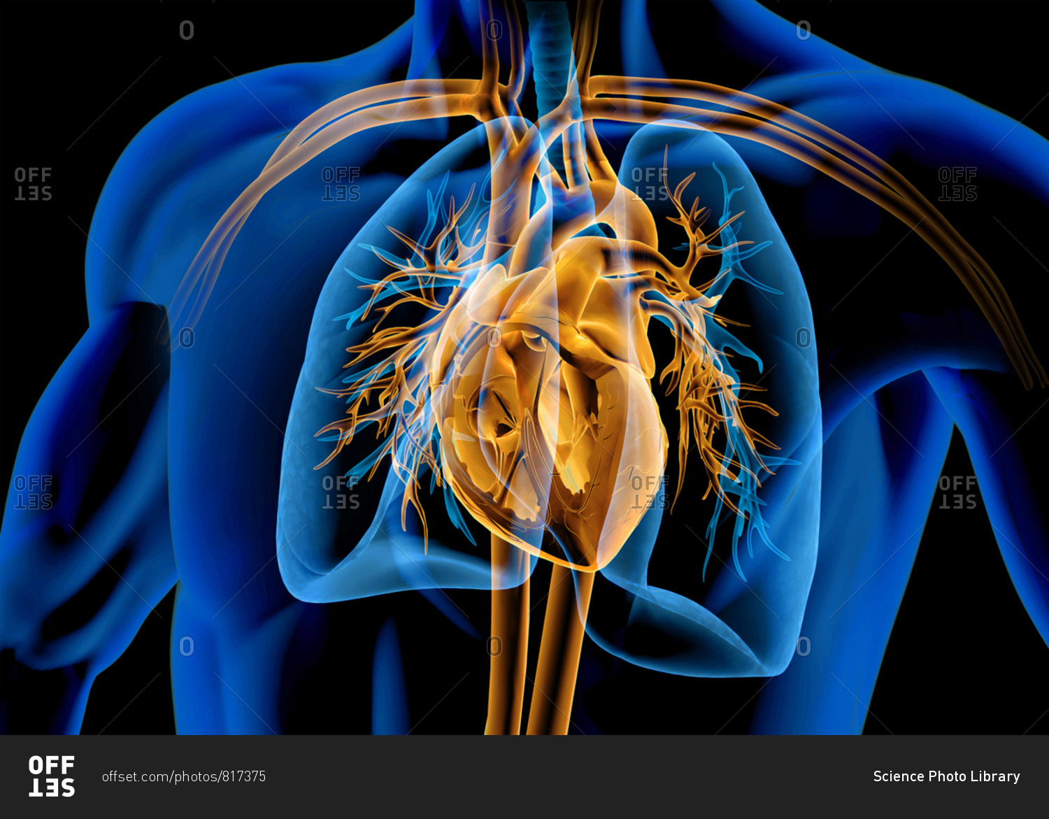 Human Heart Cross Section With Vessels Lungs Bronchial Tree And Cut Rib Cage X Ray Effect On