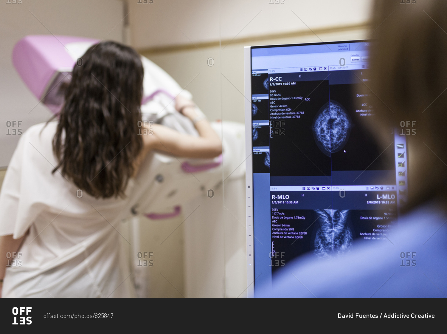 Female patient beside digital mammography unit