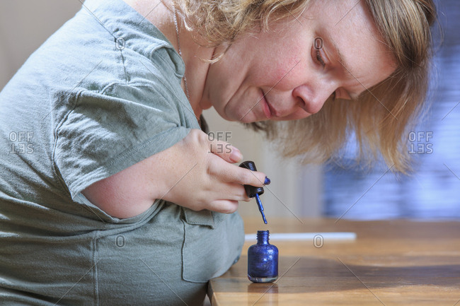 Woman with TAR Syndrome painting her nails at home.