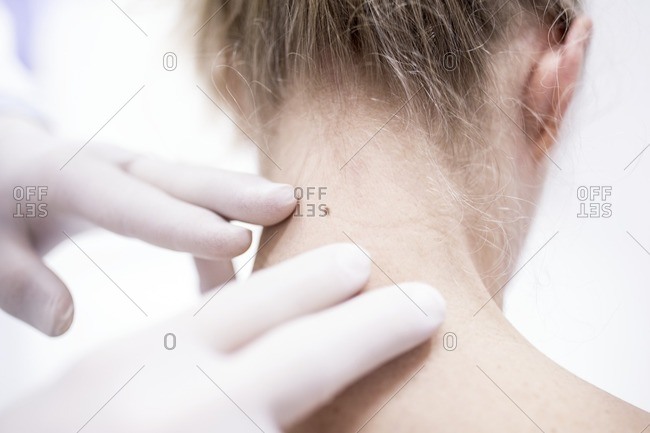 Doctor examining patient's mole on neck.