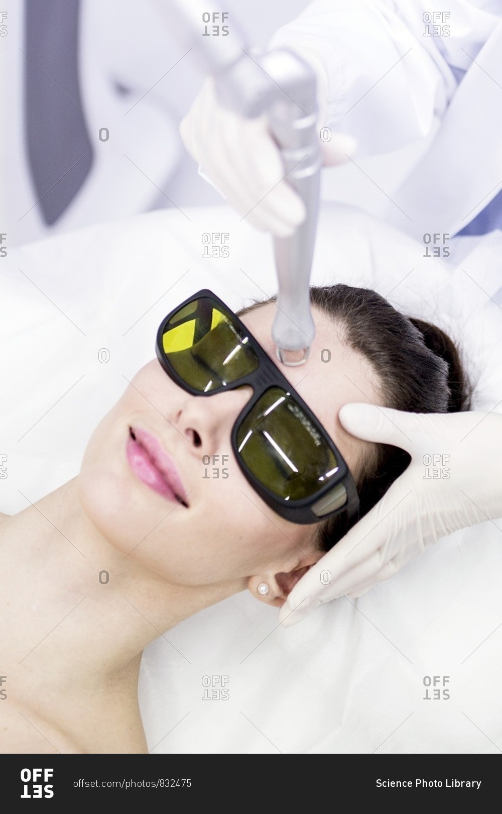 Beauty technician using laser treatment. This treatment is used to treat scars, wrinkles and stretch marks, but also for pigmentation removal.
