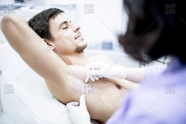 Dermatologist marking the underarm for botox injection to treat excessive sweating, close-up.
