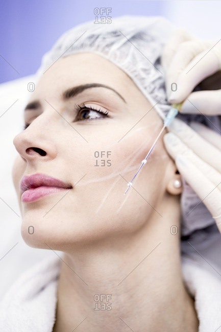 Dermatologist drawing marks on woman face for thread-lift, close-up.