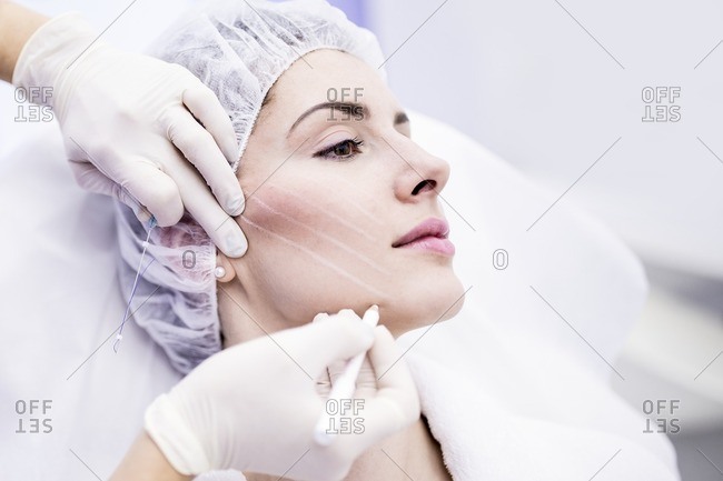 Dermatologist drawing marks on woman face for thread-lift, close-up.