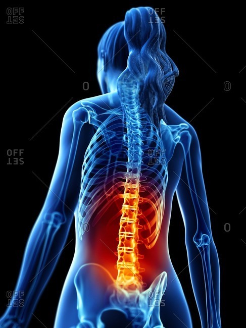 Back pain, conceptual computer illustration.