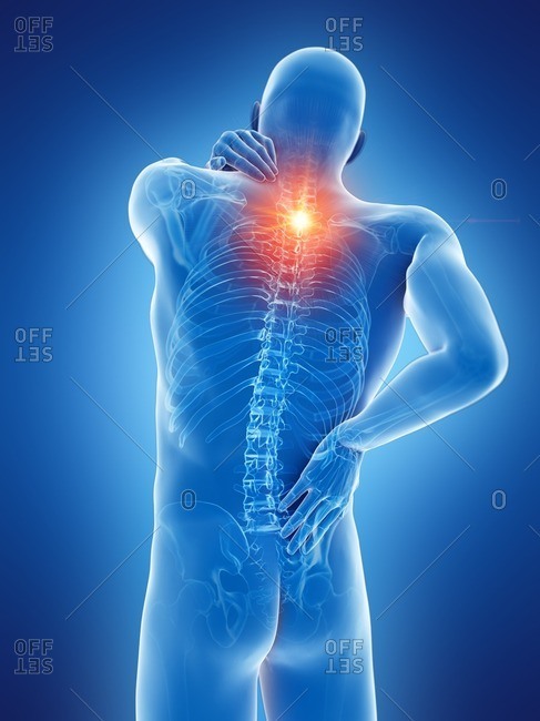 5,088 Upper Back Pain Images, Stock Photos, 3D objects, & Vectors