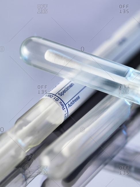 DNA (deoxyribonucleic acid) swabs used for genetic testing.