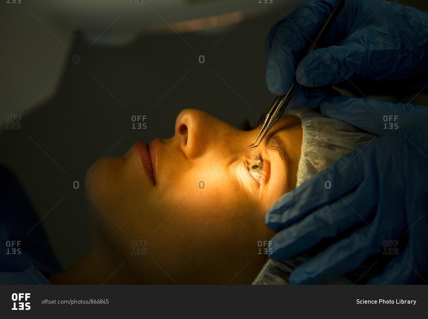 Patient undergoing laser eye surgery.