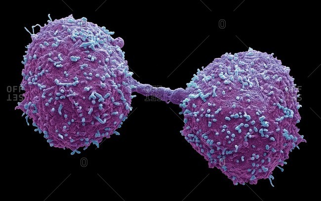 Dividing prostate cancer cells, SEM