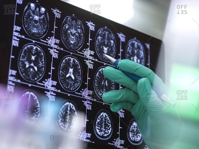 Human brain scan being analyzed in a neurology clinic.